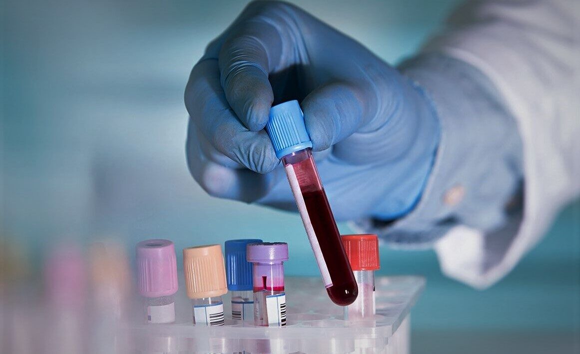 Liquid Biopsy Market Size, Share, Growth Drivers, Trends and Forecasts by 2026