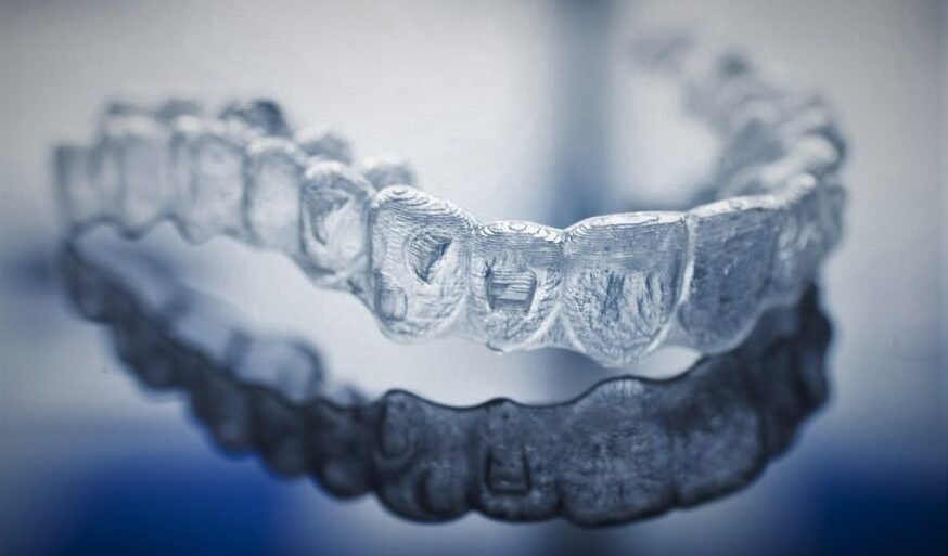 Global Clear Aligner Market Size, Share, Trends & Growth by 2026