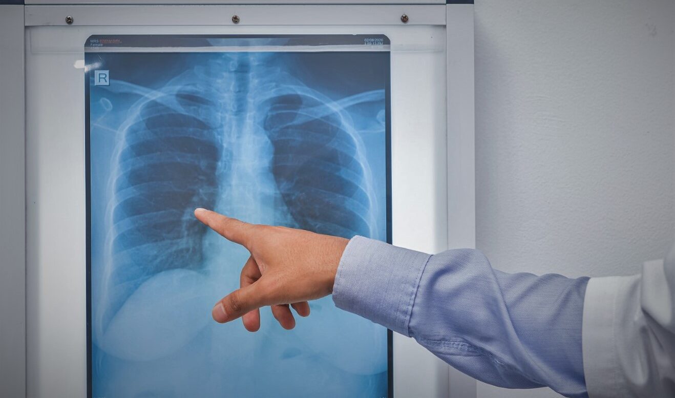 Digital X-Ray Market Size, Share, Trends, Demand, Growth & Applications 2026