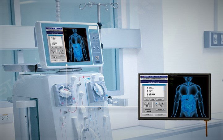 Global Medical Display Market Report – Revolutionizing the Medical Imaging World