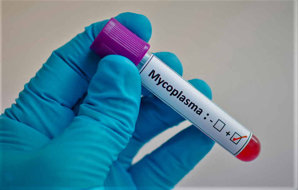 Mycoplasma Testing Market