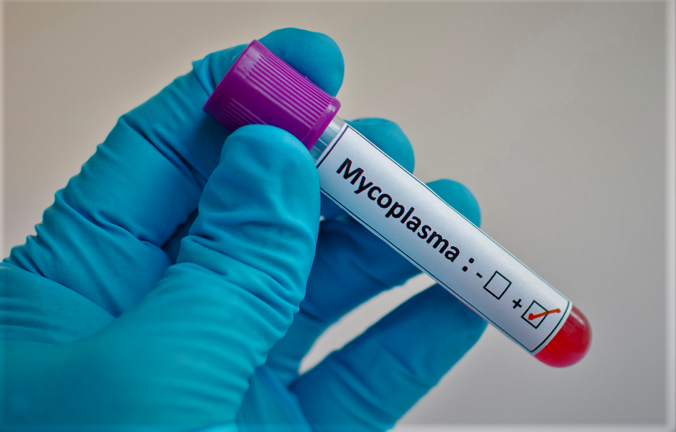 Mycoplasma Testing Market Size, Share, Trends, Growth & Developments by 2027