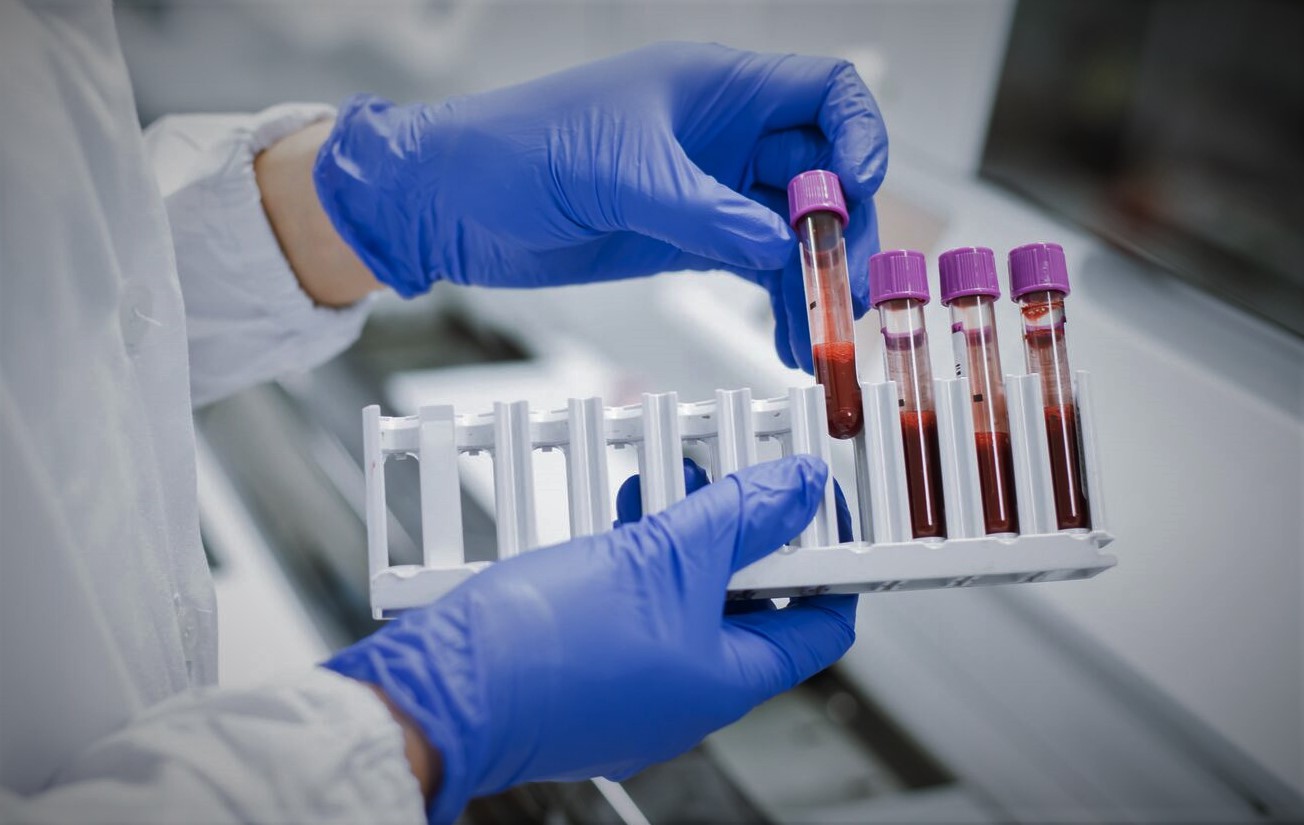 Global Hematology Market Size, Share, Growth, Trends, Demand & Analysis 2027