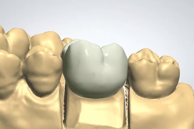 Dental CAD/CAM Market