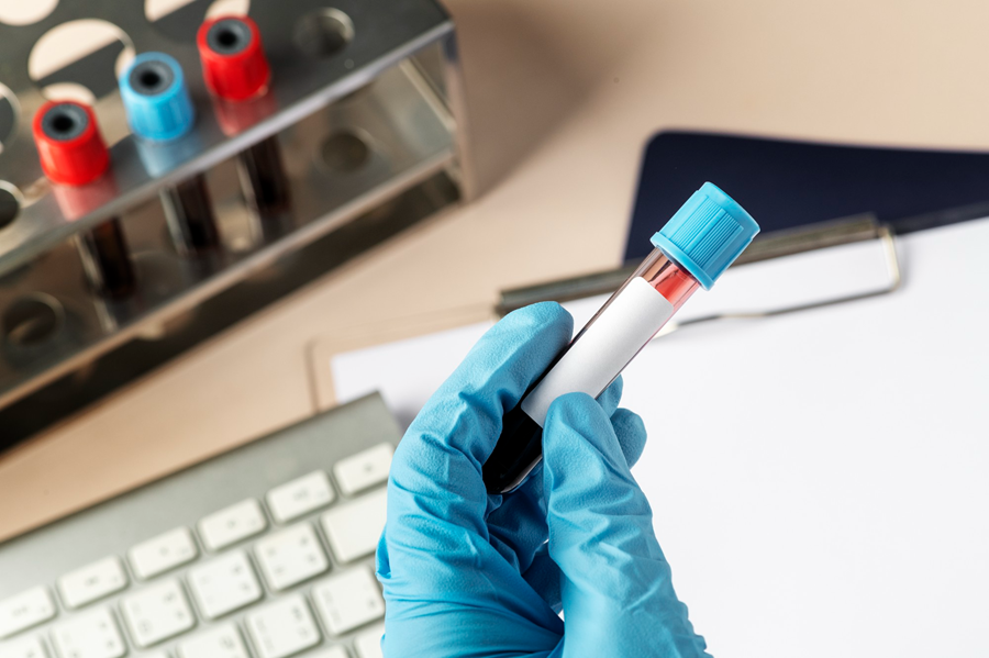Serological Testing Market – Global Industry Analysis, Size, Share, Growth and Forecast to 2028