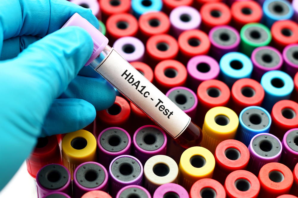 Global HbA1c Testing Market Size, Share, Industry Growth Analysis, and Forecast to 2028