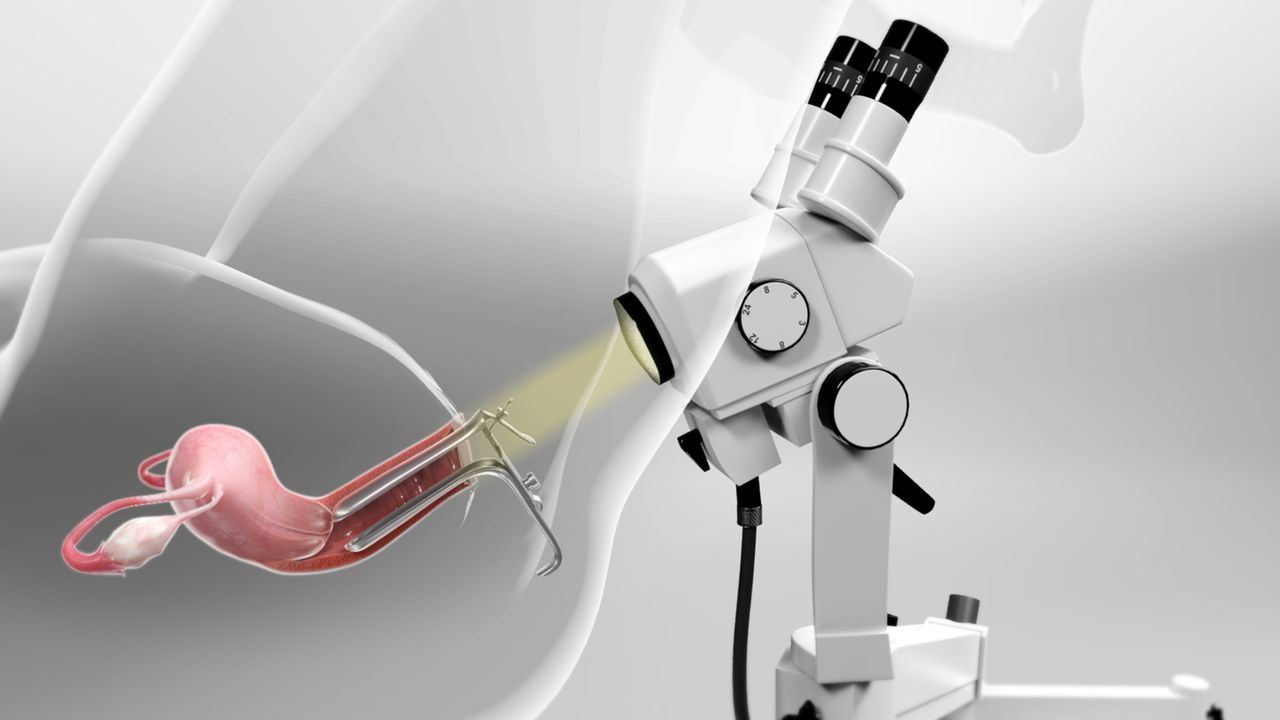 Colposcopy Market Size, Share, Growth, Trends and Forecast 2024 to 2029