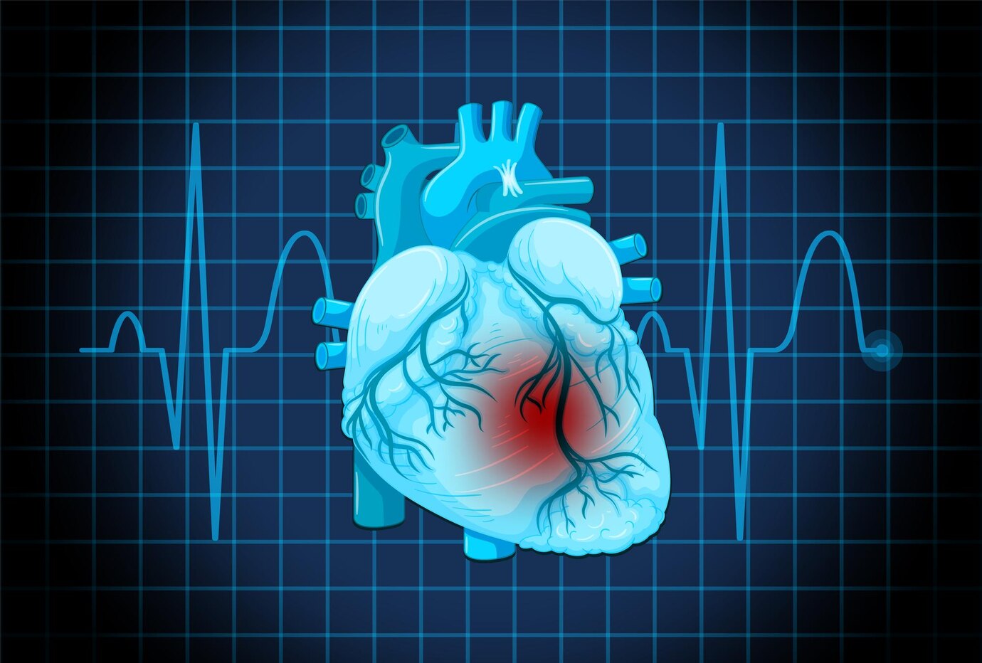 Coronary Heart Disease Diagnostic Imaging Devices