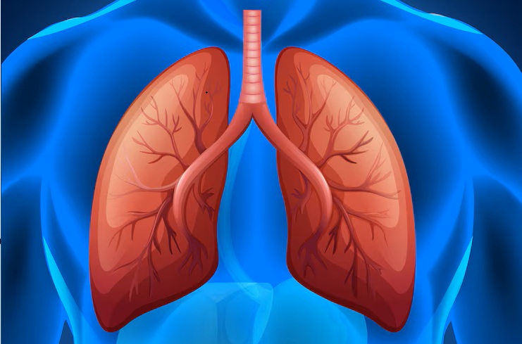 Lung Cancer Surgery