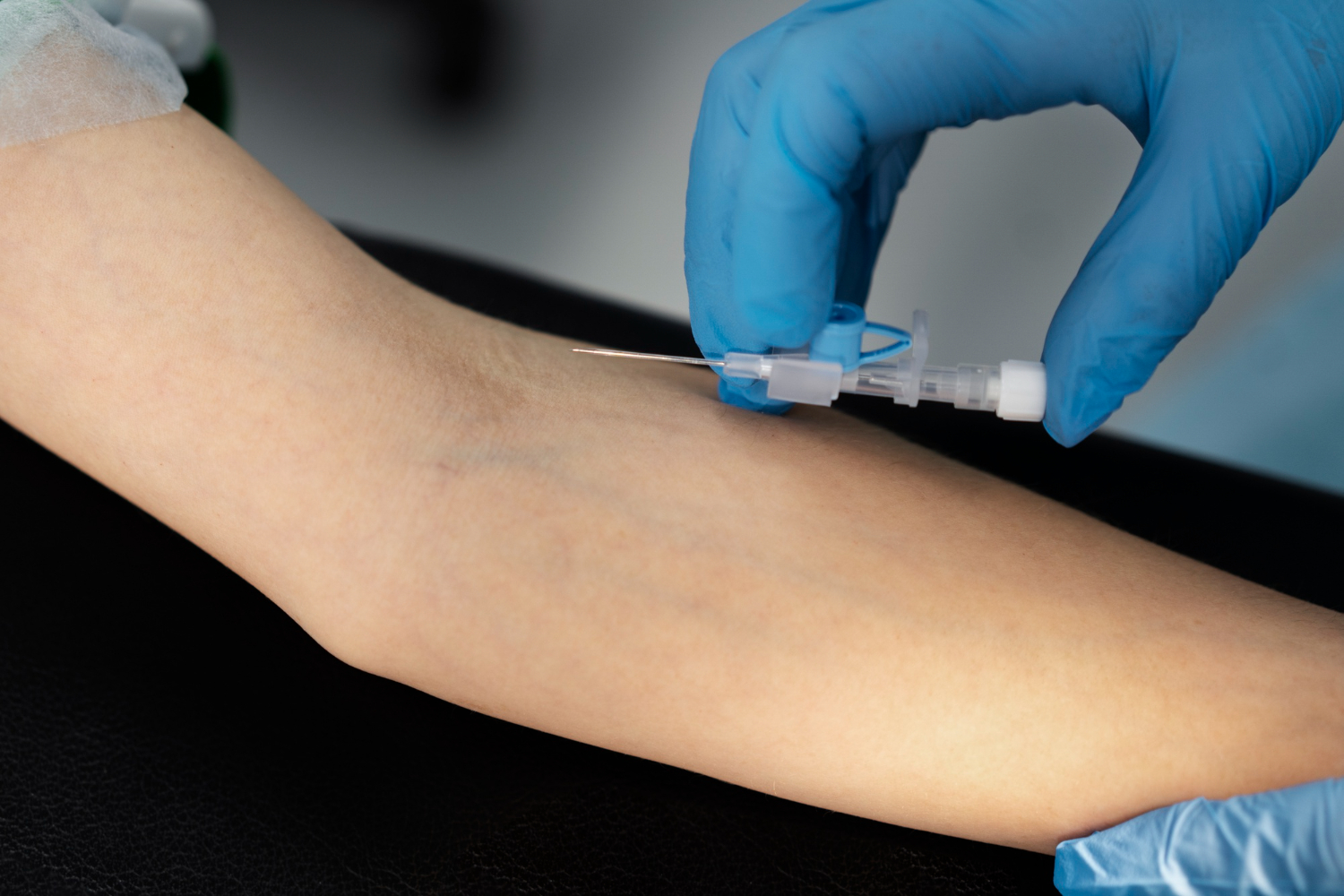 Peripheral Vascular Devices Market Report